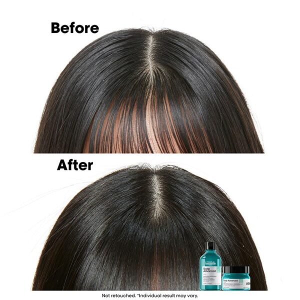 Scalp Advanced Anti-Oiliness 2-In-1 Deep Purifier Clay for Very Oily Scalp 250ml