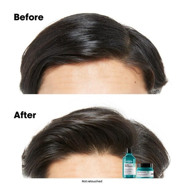 Scalp Advanced Anti-Oiliness 2-In-1 Deep Purifier Clay for Very Oily Scalp 250ml